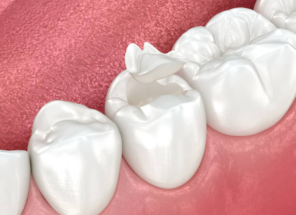 Our Range of Dental Services in Forsyth, MT