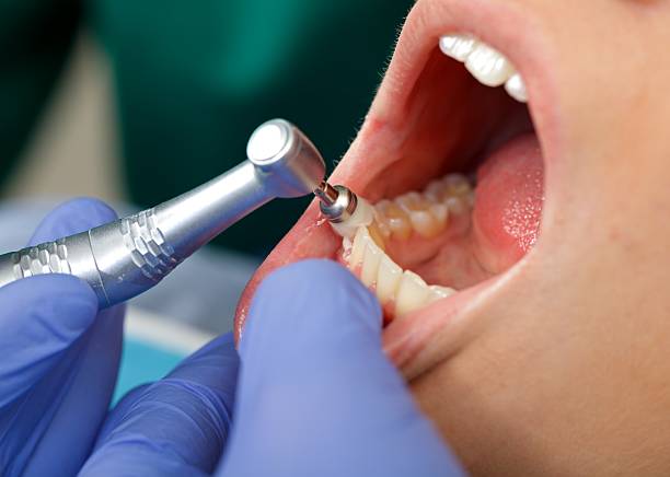 Best Tooth Extraction  in Forsyth, MT